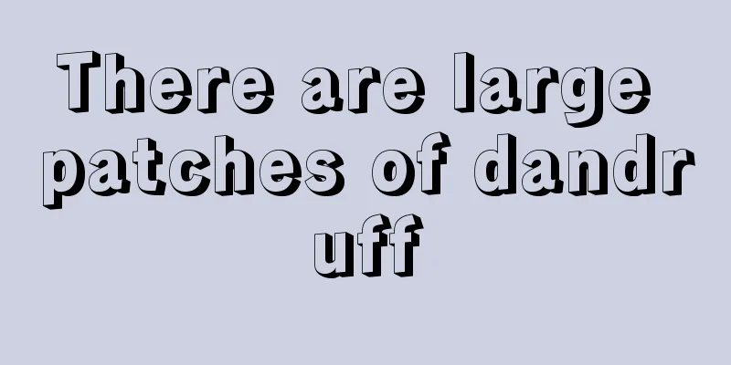 There are large patches of dandruff