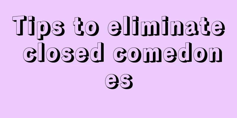 Tips to eliminate closed comedones
