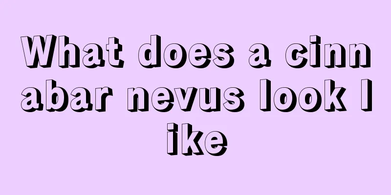 What does a cinnabar nevus look like
