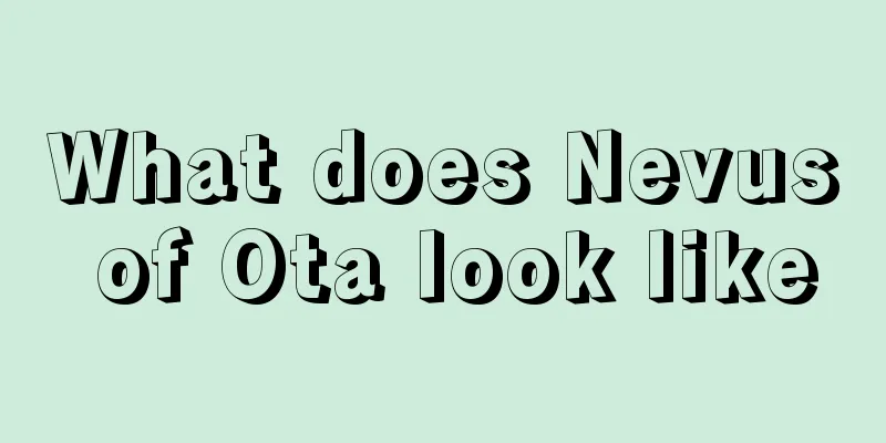 What does Nevus of Ota look like