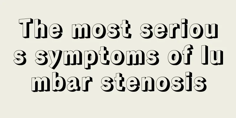 The most serious symptoms of lumbar stenosis