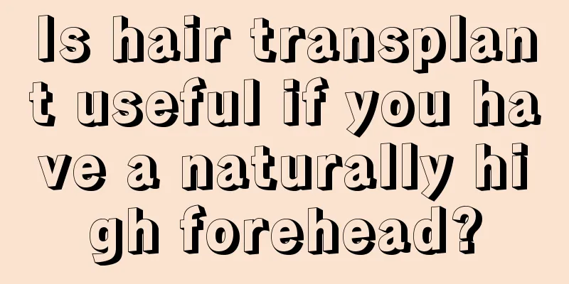 Is hair transplant useful if you have a naturally high forehead?