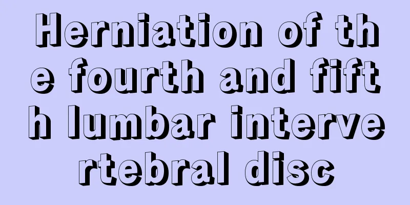 Herniation of the fourth and fifth lumbar intervertebral disc