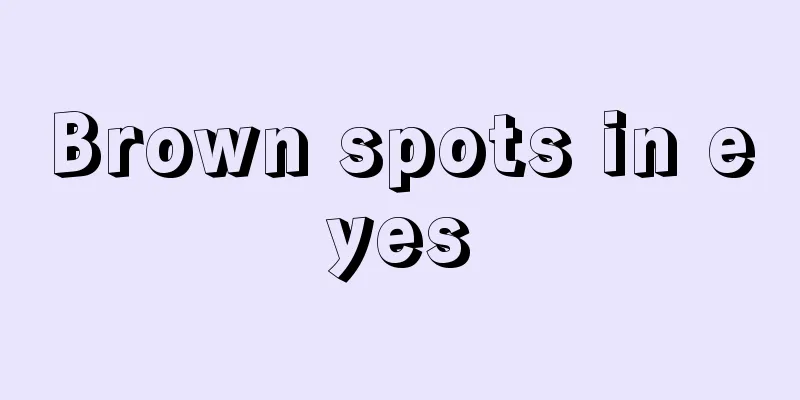 Brown spots in eyes