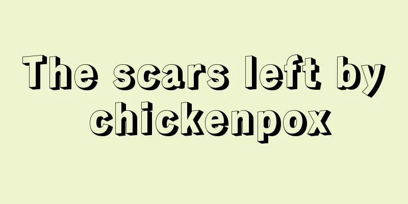 The scars left by chickenpox
