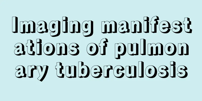 Imaging manifestations of pulmonary tuberculosis