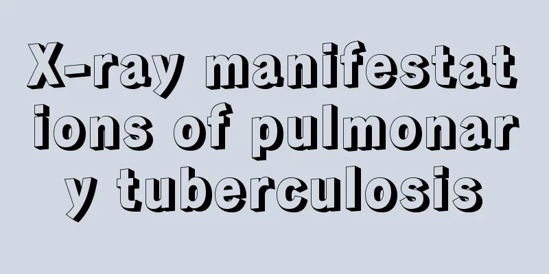 X-ray manifestations of pulmonary tuberculosis