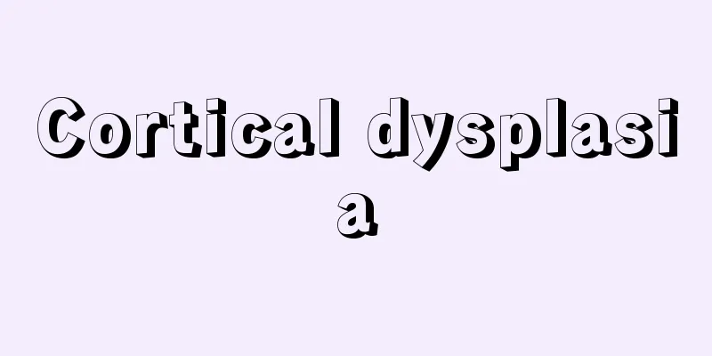 Cortical dysplasia