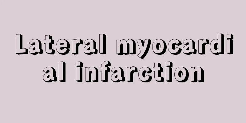 Lateral myocardial infarction