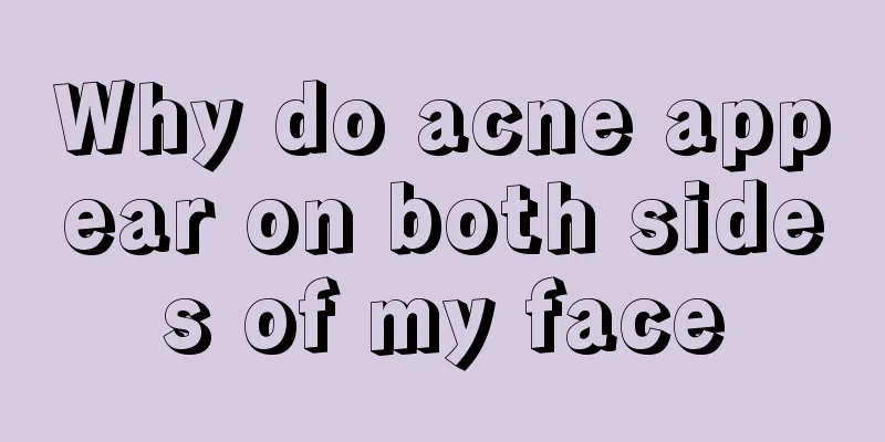 Why do acne appear on both sides of my face