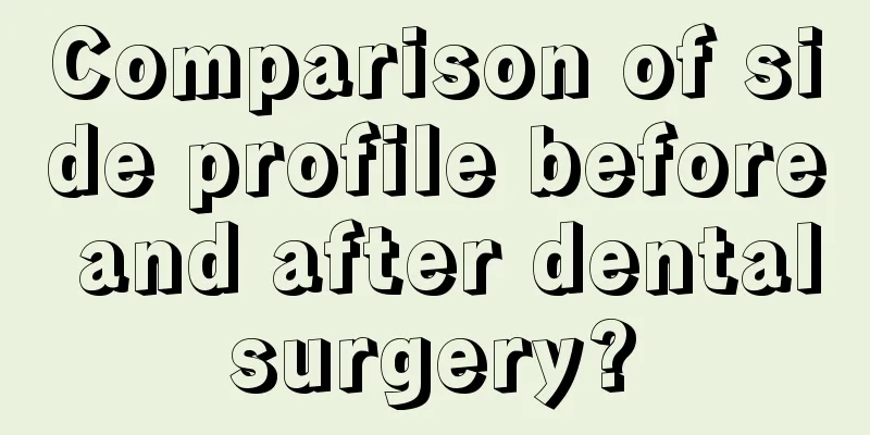 Comparison of side profile before and after dental surgery? 