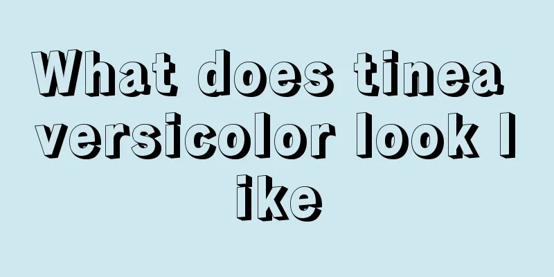 What does tinea versicolor look like