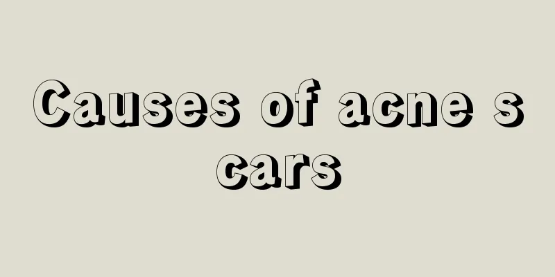 Causes of acne scars