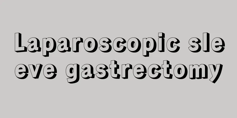 Laparoscopic sleeve gastrectomy