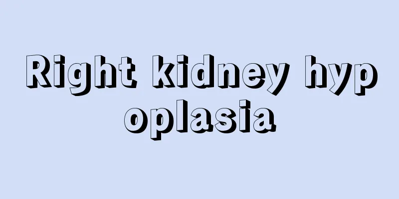Right kidney hypoplasia