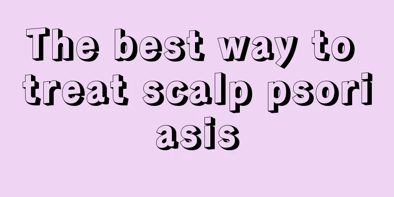 The best way to treat scalp psoriasis