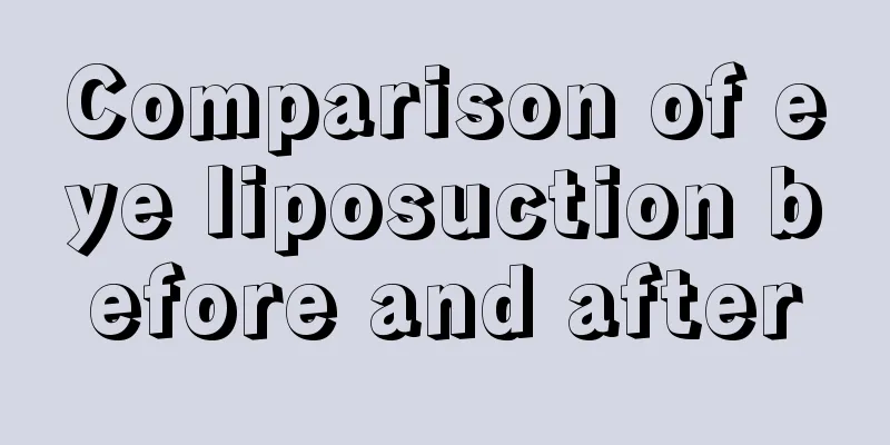 Comparison of eye liposuction before and after