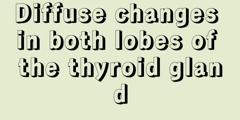 Diffuse changes in both lobes of the thyroid gland