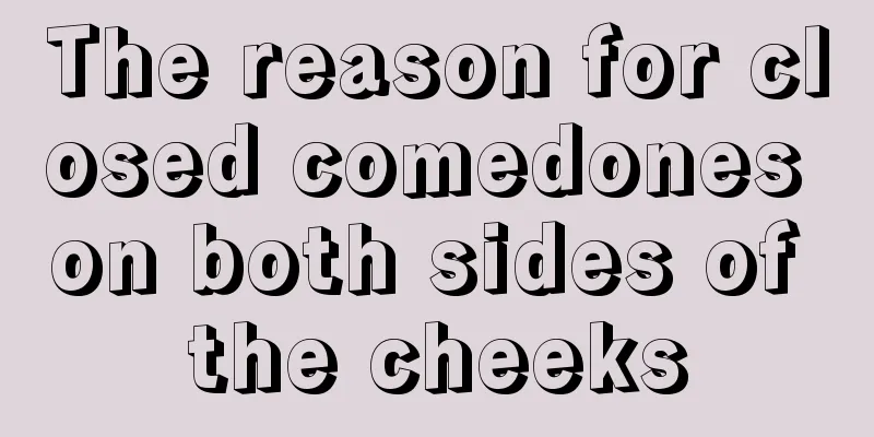 The reason for closed comedones on both sides of the cheeks
