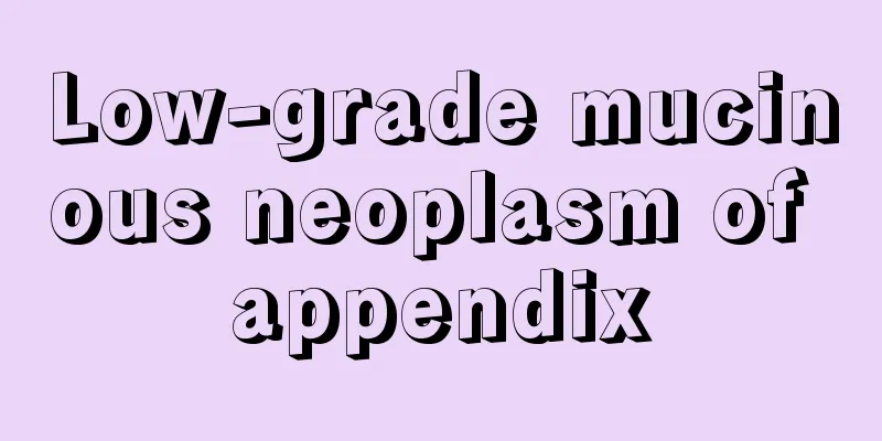 Low-grade mucinous neoplasm of appendix