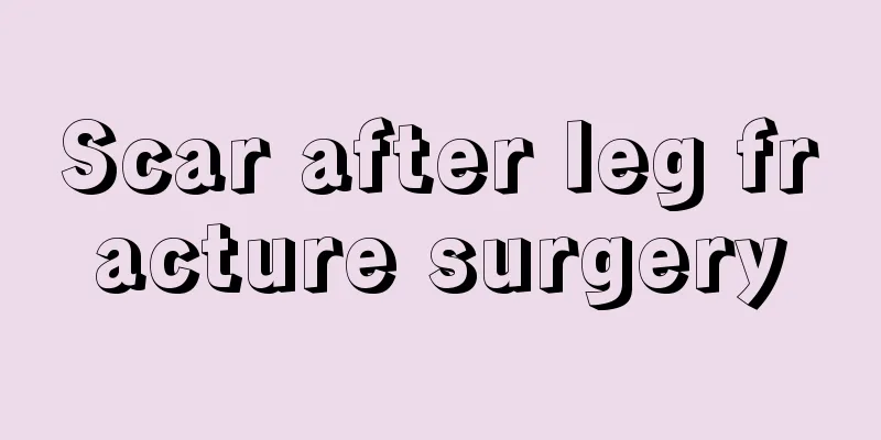 Scar after leg fracture surgery