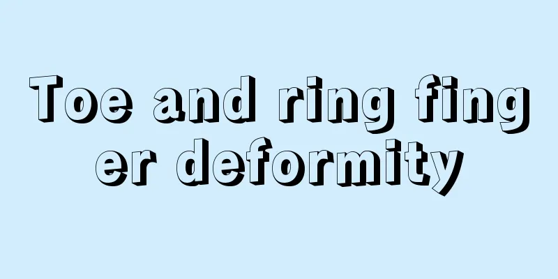 Toe and ring finger deformity