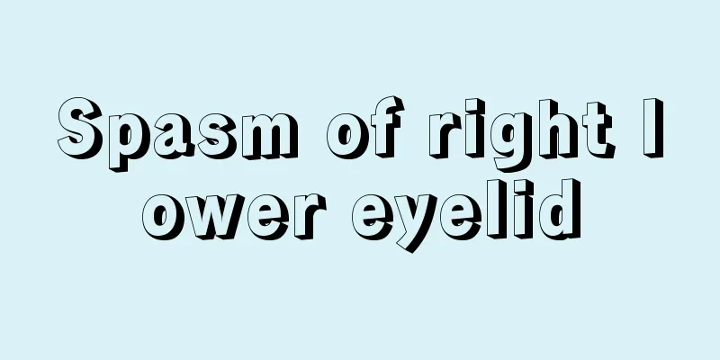 Spasm of right lower eyelid