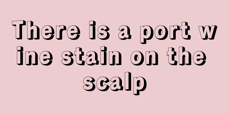 There is a port wine stain on the scalp