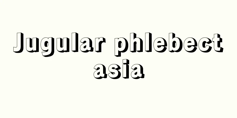 Jugular phlebectasia