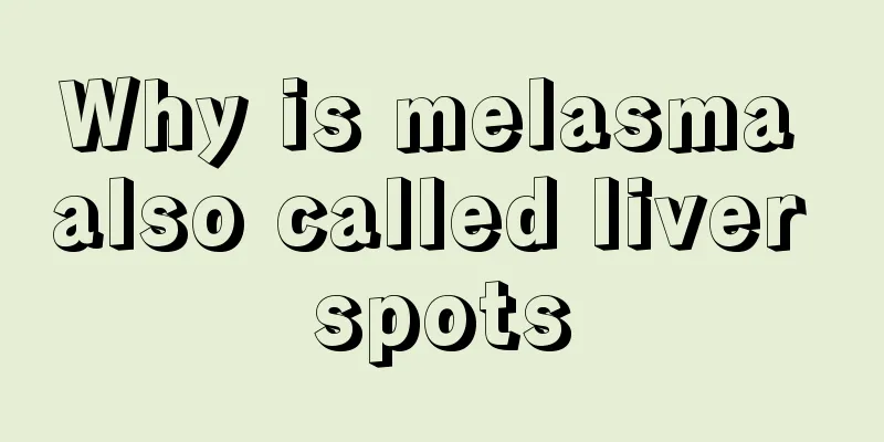 Why is melasma also called liver spots