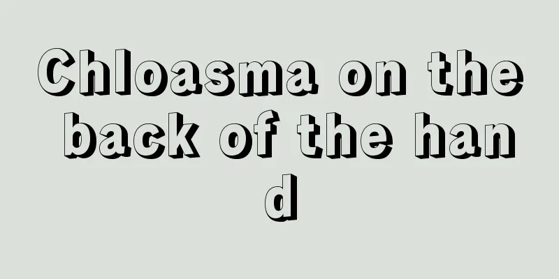 Chloasma on the back of the hand