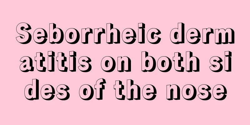 Seborrheic dermatitis on both sides of the nose