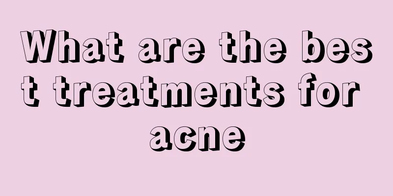 What are the best treatments for acne