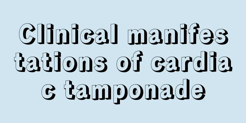 Clinical manifestations of cardiac tamponade