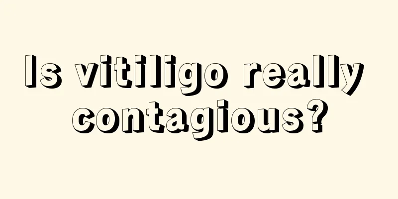 Is vitiligo really contagious?