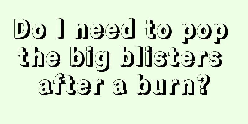 Do I need to pop the big blisters after a burn?