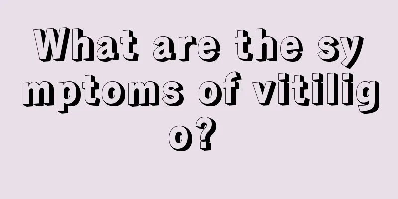 What are the symptoms of vitiligo? 