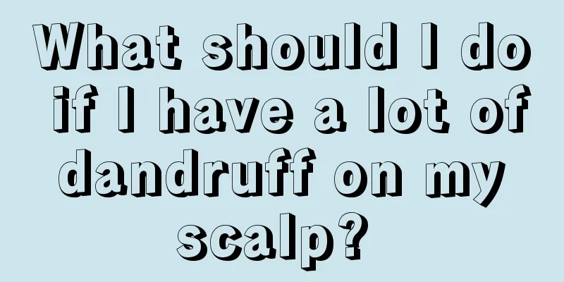 What should I do if I have a lot of dandruff on my scalp? 
