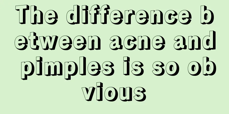 The difference between acne and pimples is so obvious