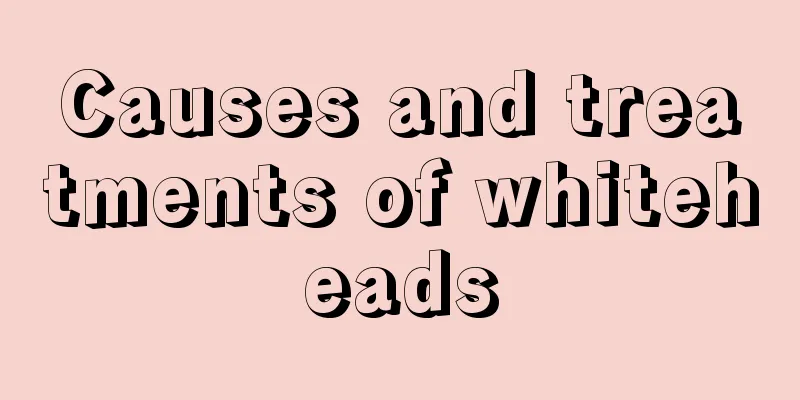 Causes and treatments of whiteheads