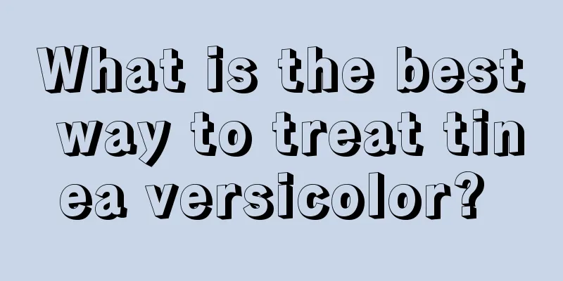 What is the best way to treat tinea versicolor? 