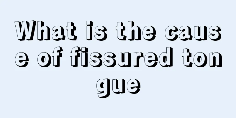 What is the cause of fissured tongue