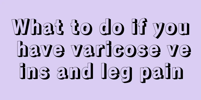 What to do if you have varicose veins and leg pain