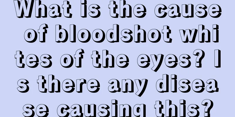 What is the cause of bloodshot whites of the eyes? Is there any disease causing this?