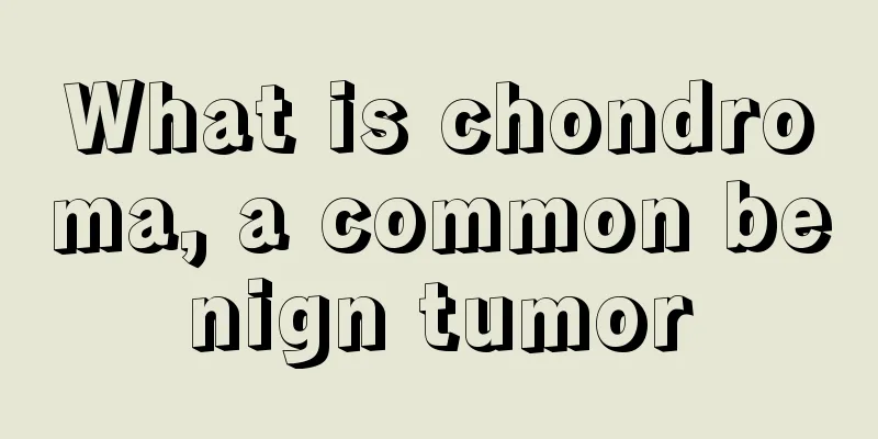 What is chondroma, a common benign tumor