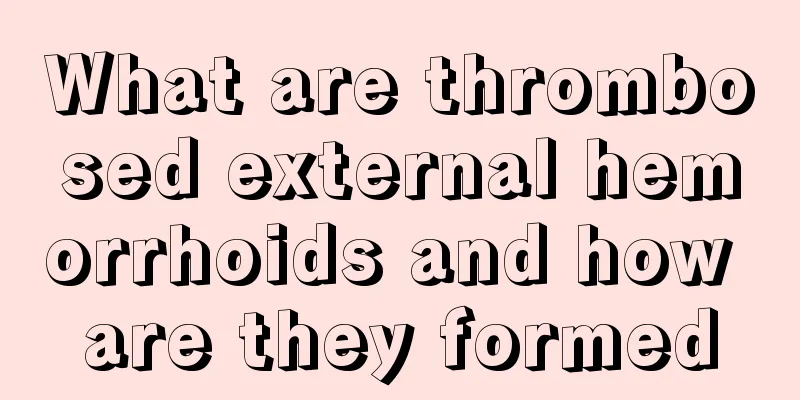 What are thrombosed external hemorrhoids and how are they formed
