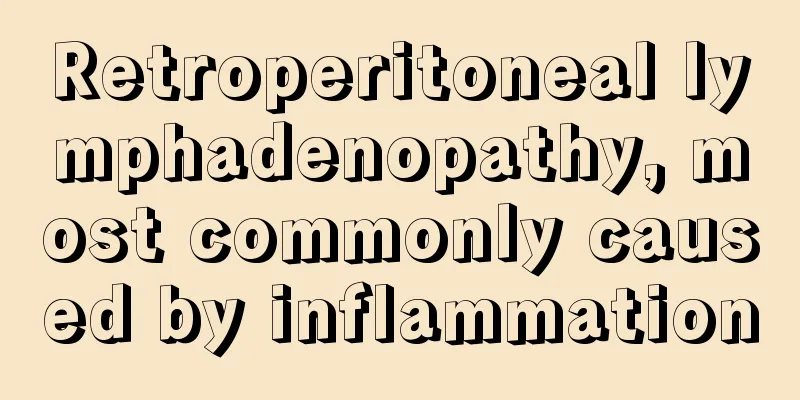 Retroperitoneal lymphadenopathy, most commonly caused by inflammation