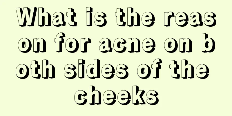 What is the reason for acne on both sides of the cheeks