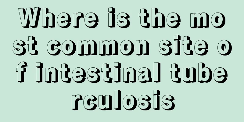 Where is the most common site of intestinal tuberculosis