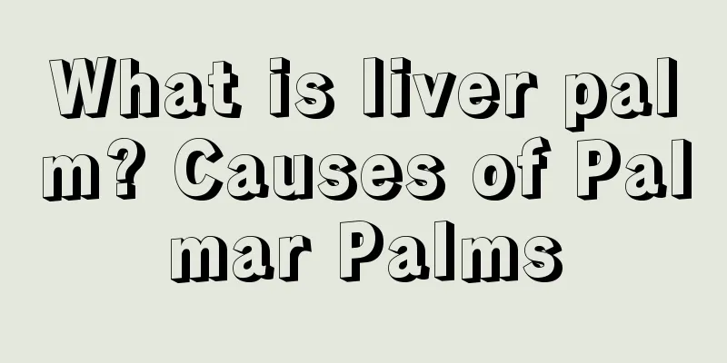 What is liver palm? Causes of Palmar Palms